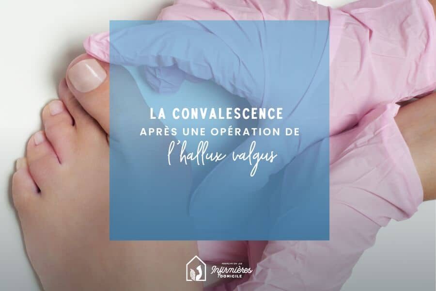 La convalescence après une opération de l’hallux valgus